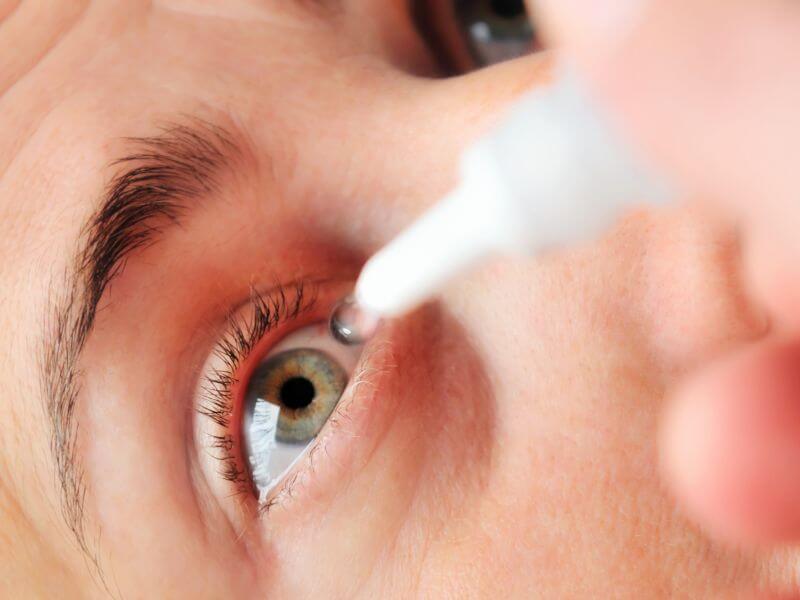 Аллергия на глазные капли фото